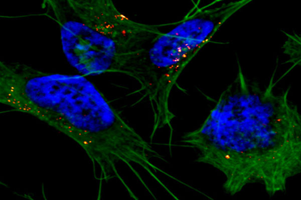 The shape-shifting protein behind Alzheimer’s disease