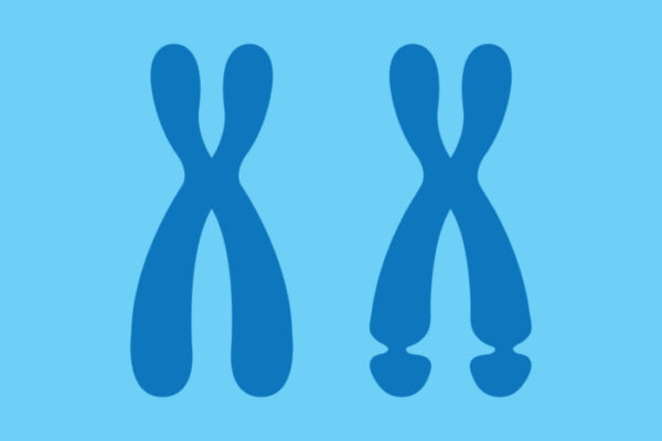 New explanation offered for symptoms of fragile X syndrome