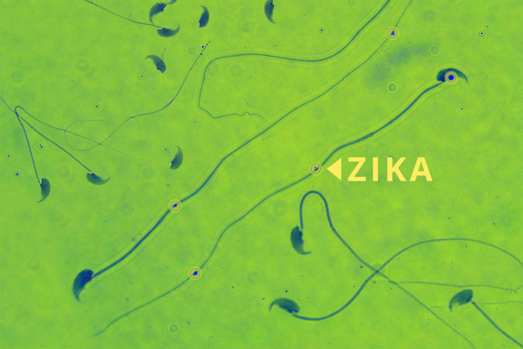 Zika in mouse sperm