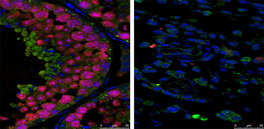 image of mouse testes, healthy and affected by Zika