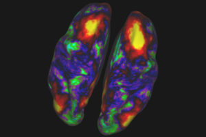colorful brain scan