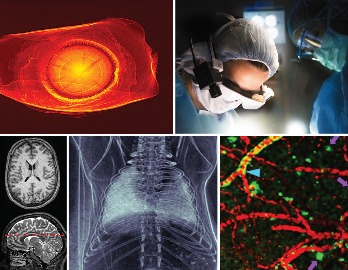 Washington University invests $25 million in imaging sciences - The ...