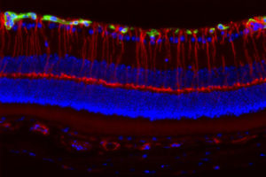 retina image