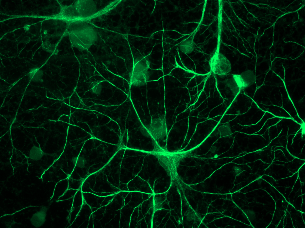 Clock stars: Astrocytes keep time for brain, behavior - The Source - WashU