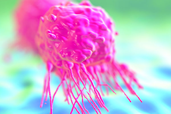 Detecting, diagnosing women’s cancers in new ways