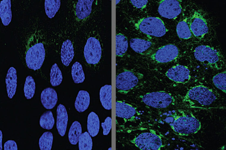 Human placental cells (blue) infected with Zika virus (green)