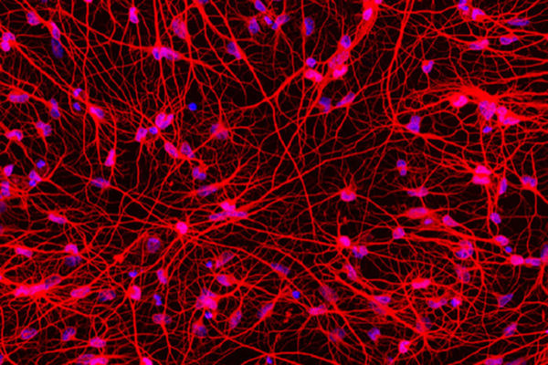 A new tool to study Huntington’s disease