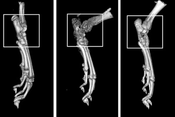 Drug compound shows promise against rheumatoid arthritis