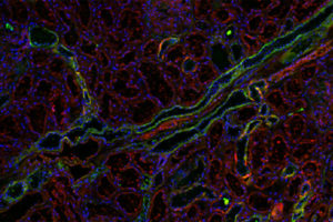 kidney tissue