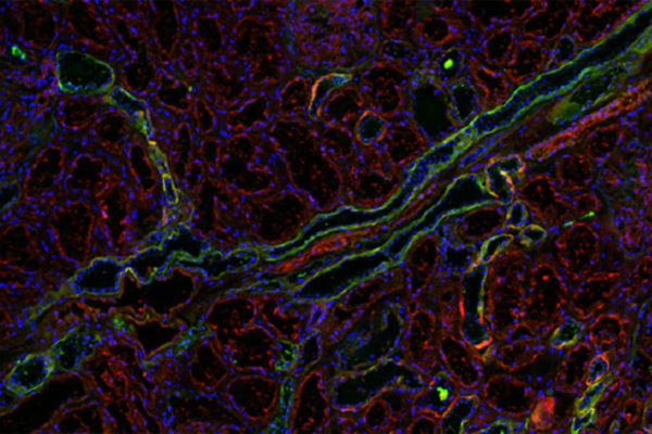 Decoy molecules target E. coli to treat UTIs in mice