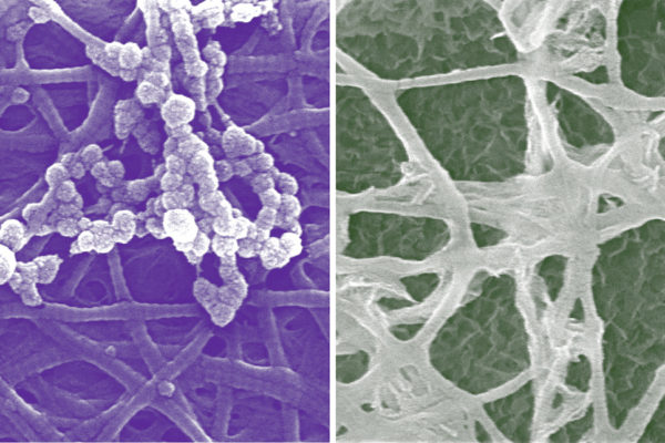 New cellular insights in bone development