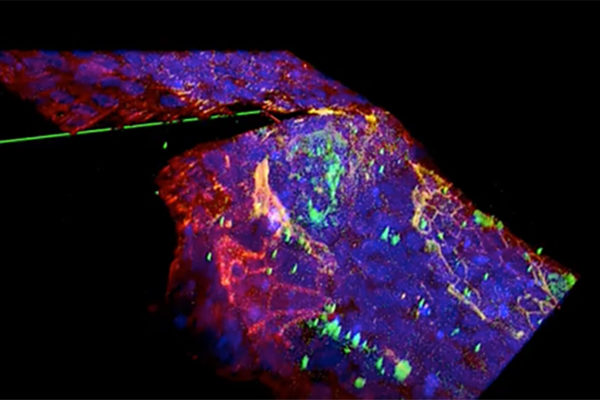 Defects in tissue trigger disease-like transformation of cells