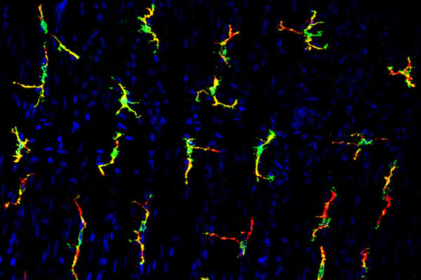 Chemotherapy-induced diarrhea traced to immune cells