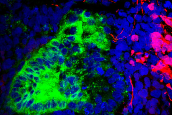 Brain, muscle cells found lurking in kidney organoids grown in lab