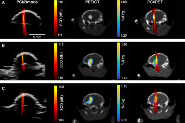 A new method for precision drug delivery: painting