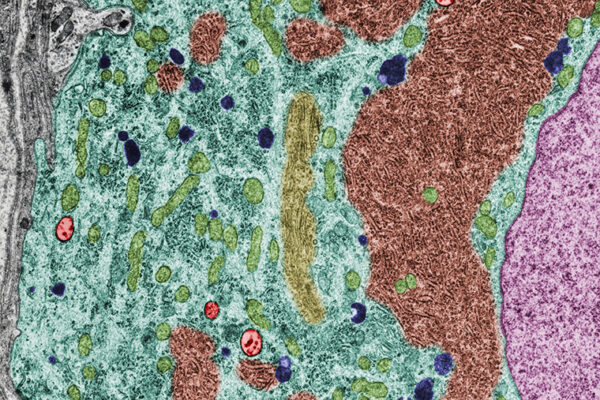 Tidying up: A new way to direct trash to autophagy