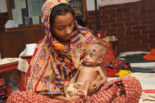 For malnourished children, new therapeutic food boosts gut microbes, healthy development