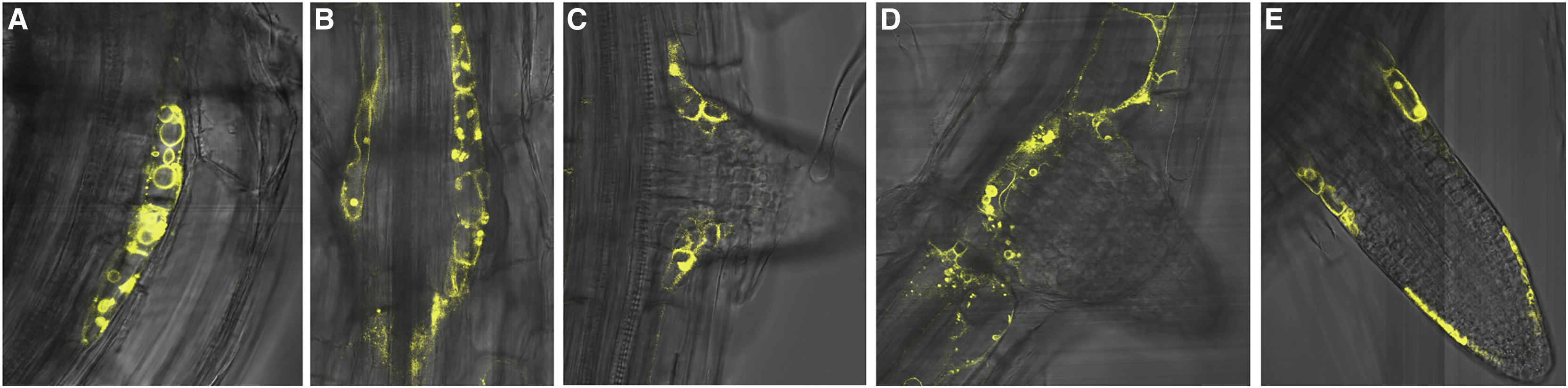 lateral root 