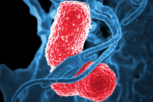 Vaccine against deadly superbug Klebsiella effective in mice