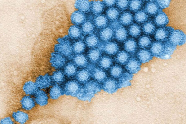 Gut microbes alter characteristics of norovirus infection