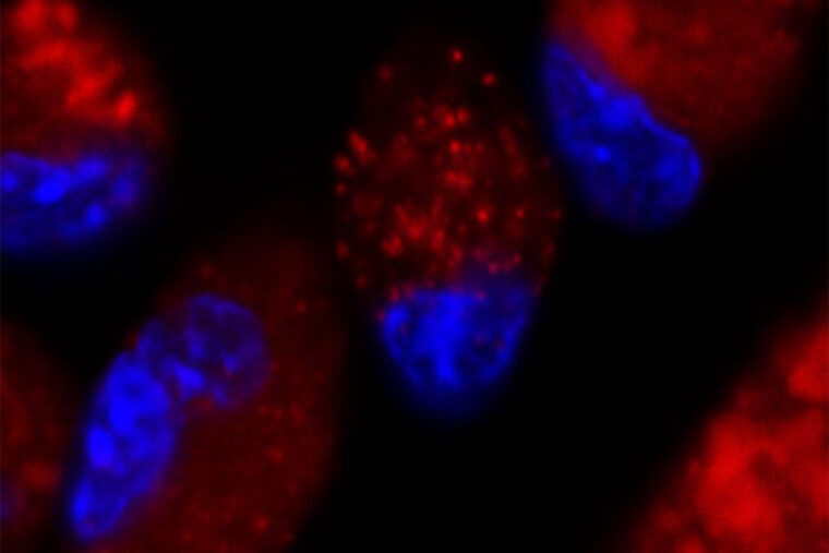 heart immune cells