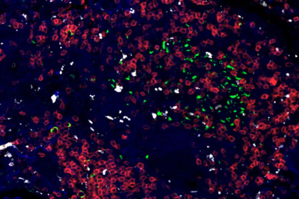 Immune responses to tuberculosis mapped across 3 species