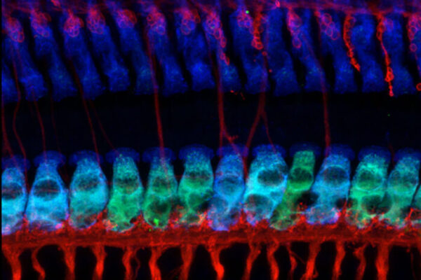 Noise-induced hearing loss blocked with drug compound