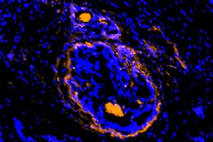 new tumor imaging agent