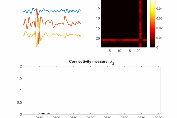 Artificial intelligence identifies, locates seizures in real-time