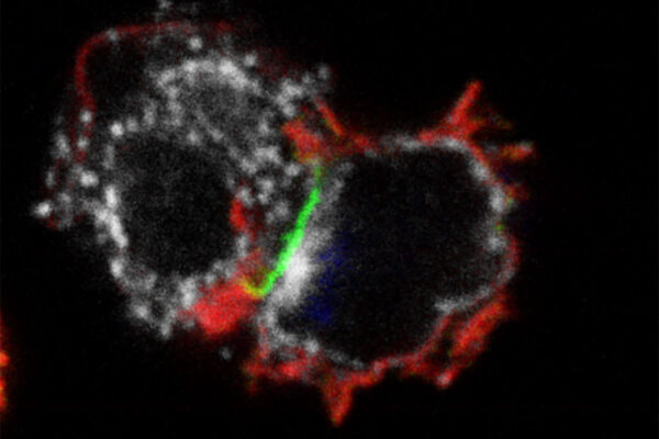 Two immunotherapies merged into single, more effective treatment