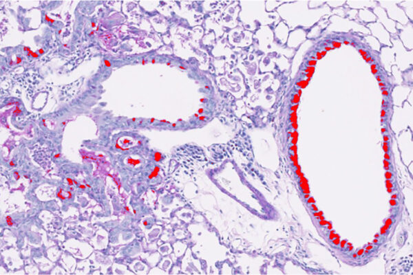 Drug development for severe respiratory diseases supported with $3.9 million grant