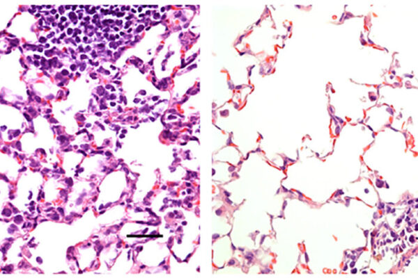 Nasal vaccine against COVID-19 prevents infection in mice