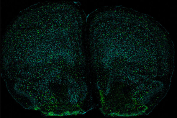 Immune system affects mind and body, study indicates