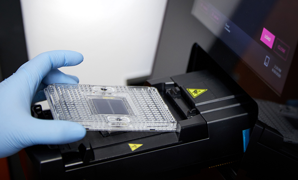 School of Medicine researchers developed, in collaboration with the biotechnology company Fluidigm, a COVID-19 saliva test that is faster and simpler than nasal or oral swab tests. According to researchers, the saliva test allows for rapid testing of large numbers of people. (Photo: Matt Miller/Washington University School of Medicine)