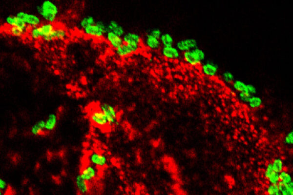 Toxin provides clues to long-term effects of diarrhea caused by E. coli