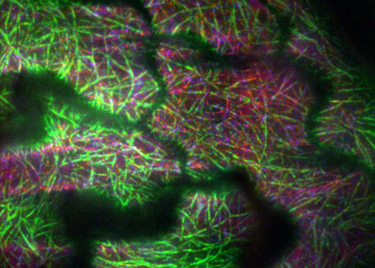 microtubule tracks