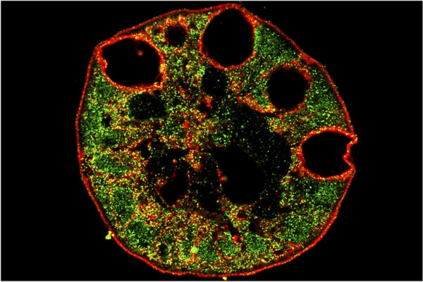 For some, GI tract may be vulnerable to COVID-19 infection