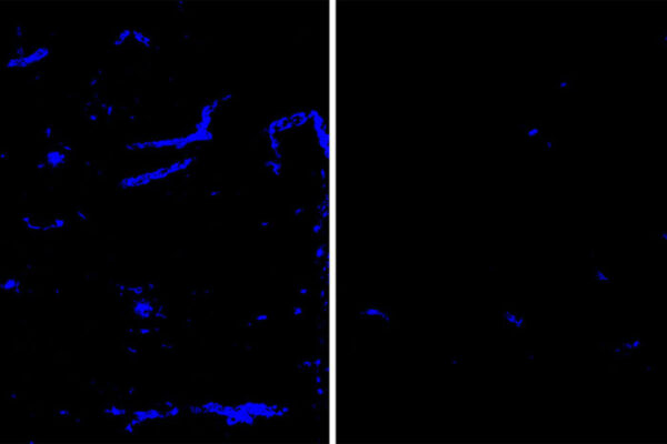 Protein linked to Alzheimer’s, strokes cleared from brain blood vessels