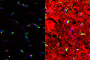 side by side fluorescent images