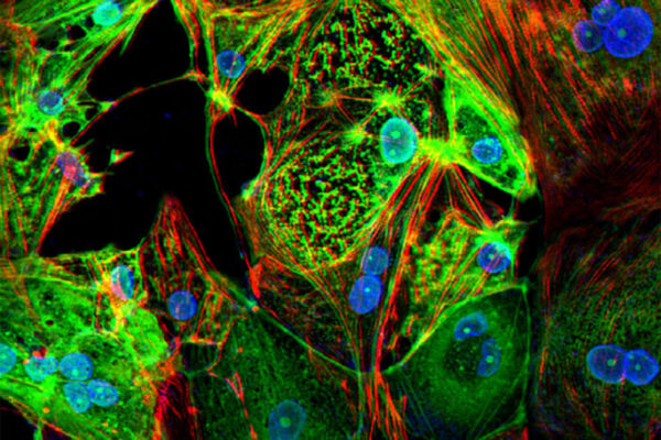 COVID-19 can kill heart muscle cells, interfere with contraction