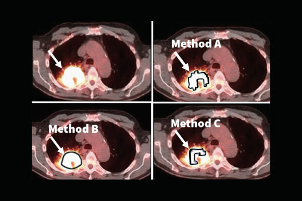 Jha to develop imaging methods with $1.8M NIH grant