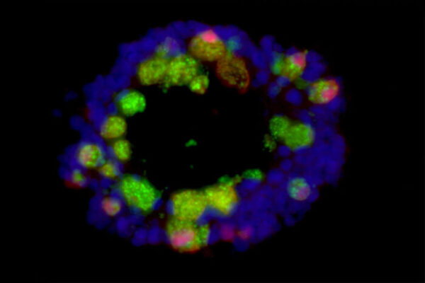 Western diet may increase risk of gut inflammation, infection