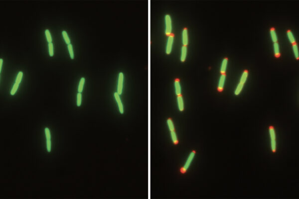 Shrinking to survive: Bacteria adapt to a lifestyle in flux