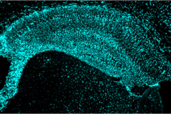 Protein linked to heart health, disease a potential therapeutic target for dementia