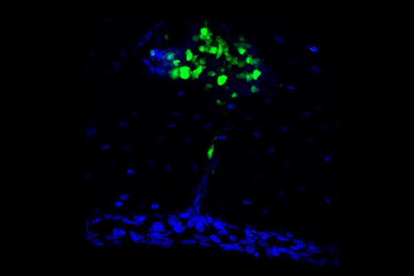 Studies reveal skull as unexpected source of brain immunity