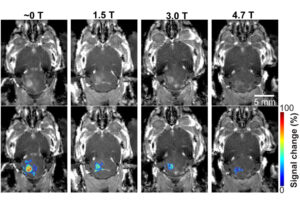 Ultrasound images of mri-guided focused ultrasound-induced blood brain barrier opening