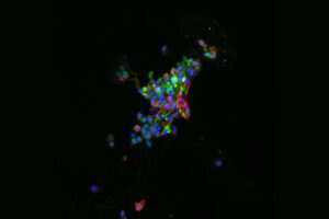 Image of cells lit up with fluorescence