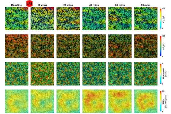 High-tech imaging reveals blood, oxygen flow, energy metabolism in mouse kidneys