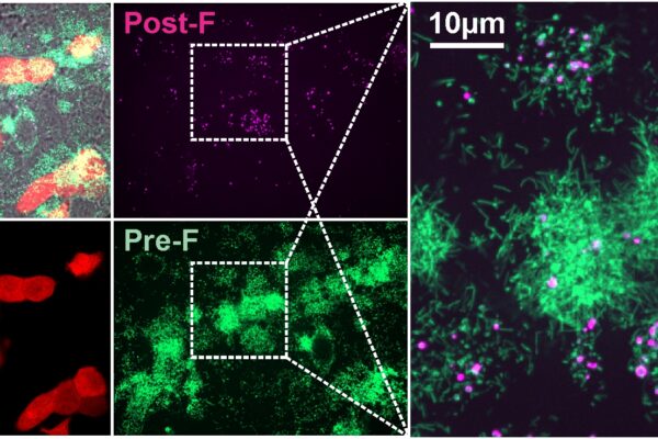 Shape of virus may determine RSV infection outcomes