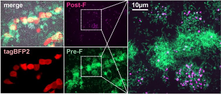 Imaging picture of RSV particles in cell culture